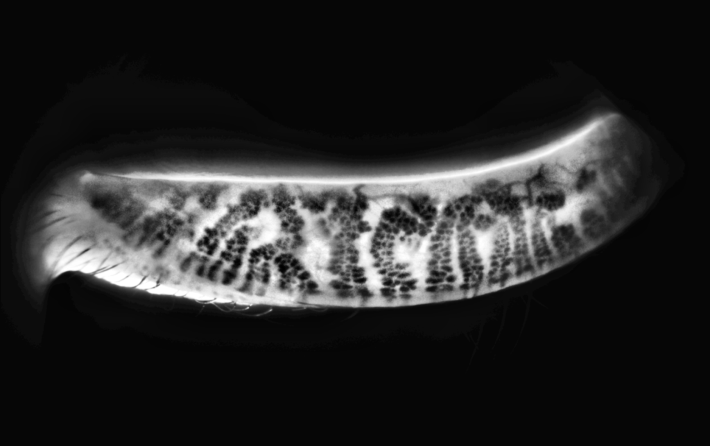 Meibographie transillumination